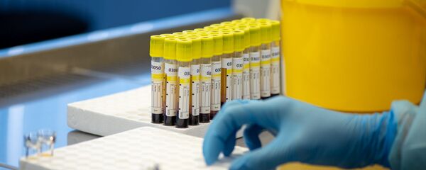 ლაბორატორია ლაბორატორია - Sputnik საქართველო