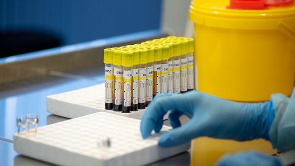 Лаборатория для проведения тестов на антитела к коронавирусу в Республиканском центре профилактики СПИДа - Sputnik Грузия