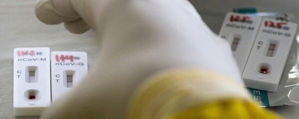 ლაბორატორია - Sputnik საქართველო