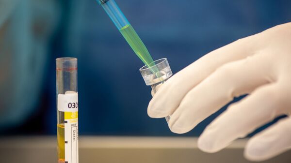 Лаборатория для проведения тестов на антитела к коронавирусу в Республиканском центре профилактики СПИДа - Sputnik Грузия