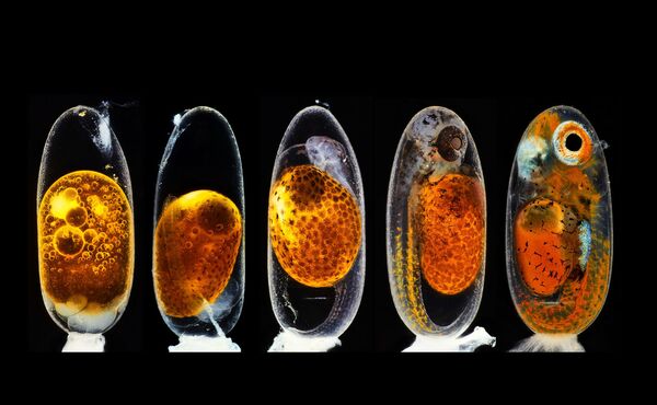 Второе место в конкурсном отборе заняла фотография немецкого исследователя Даниэля Кнопа. Он создал изображение, показывающее пять различных стадий эмбрионального развития рыбы-клоуна - Sputnik Грузия