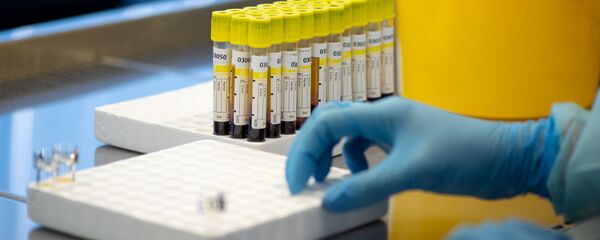 Лаборатория для проведения тестов на антитела к коронавирусу в Республиканском центре профилактики СПИДа - Sputnik Грузия