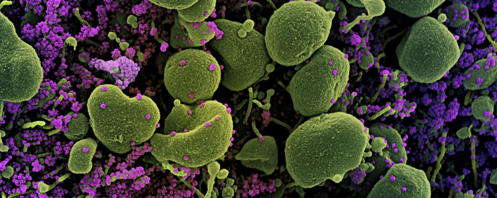 Клетка коронавируса под микроскопом  - Sputnik Грузия, 1920, 02.02.2021