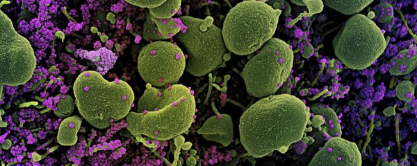 Клетка коронавируса под микроскопом  - Sputnik Грузия