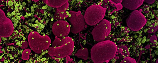 Клетка коронавируса под микроскопом  - Sputnik Грузия