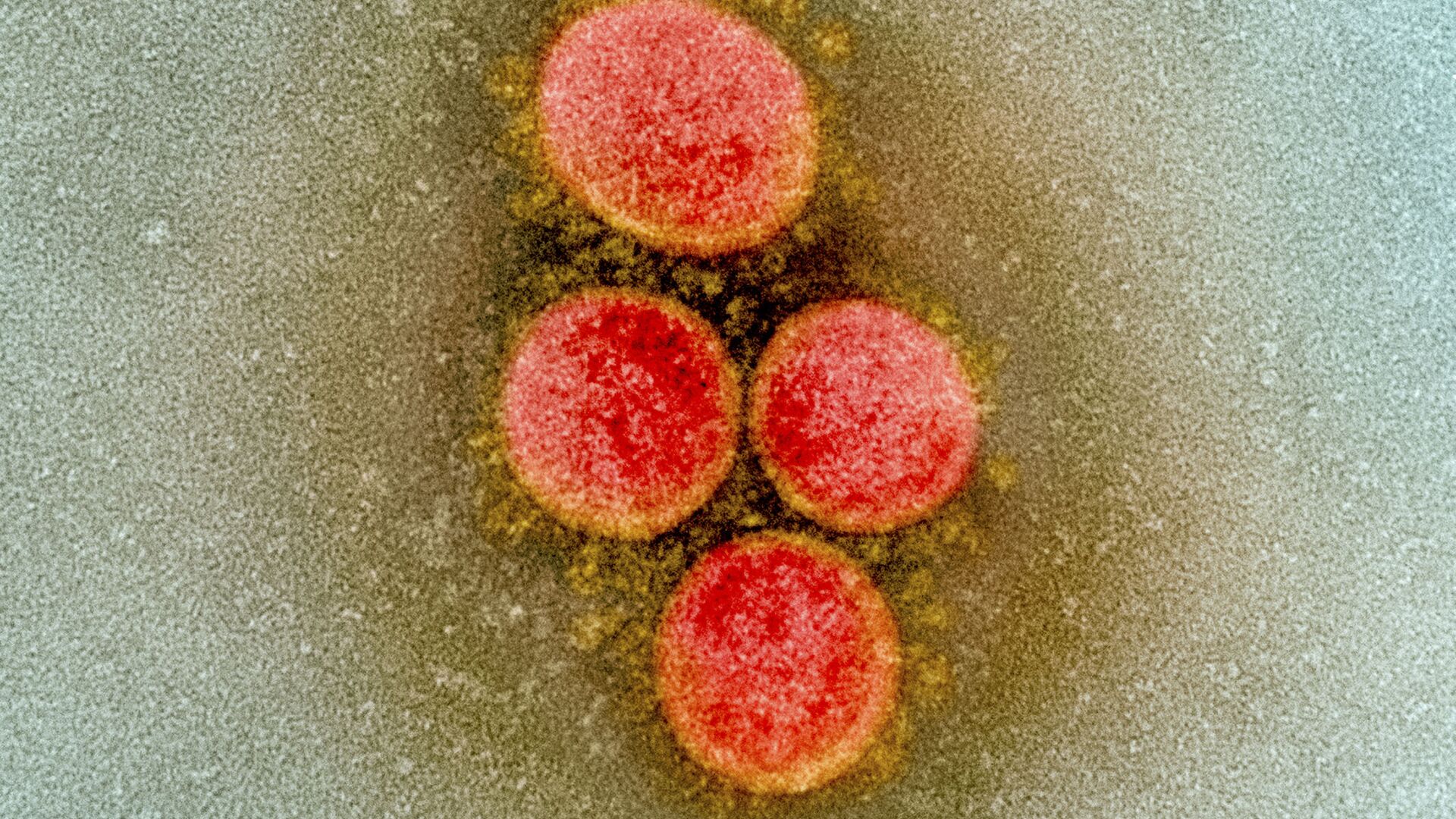 Клетка коронавируса под микроскопом  - Sputnik Грузия, 1920, 08.12.2021