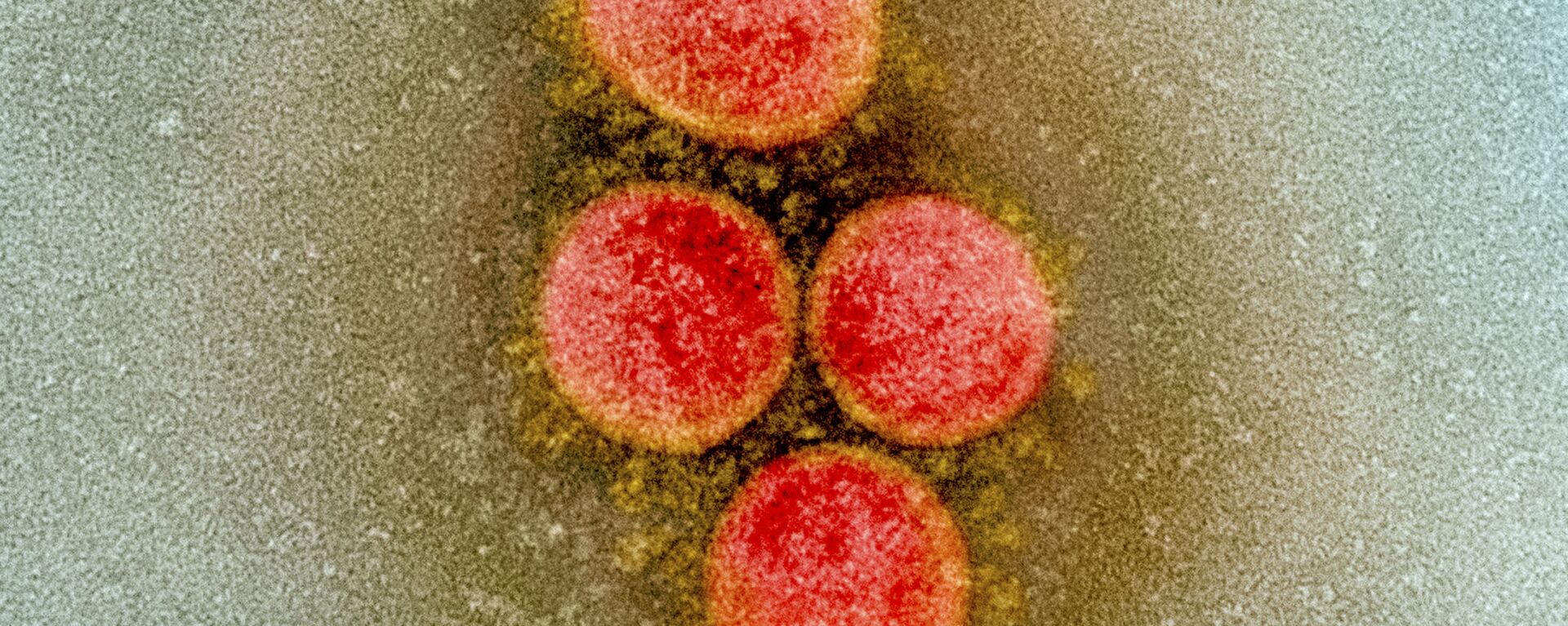 Клетка коронавируса под микроскопом  - Sputnik Грузия, 1920, 04.12.2020