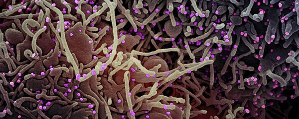 Клетка зараженная коронавирусом под микроскопом - Sputnik Грузия