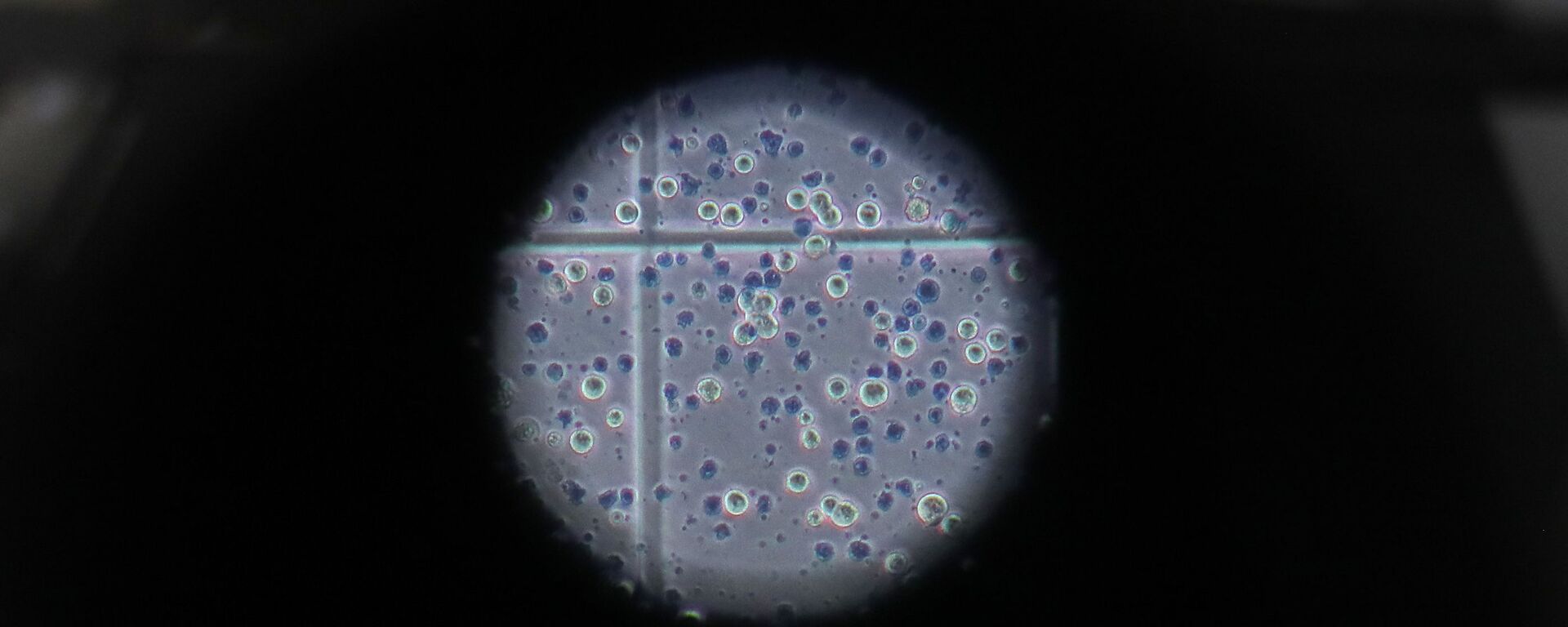 Клетки коронавируса под микроскопом - Sputnik Грузия, 1920, 19.07.2021