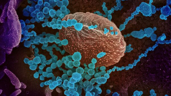 Вид на зараженную коронавирусом  клетку под микроскопом  - Sputnik Грузия