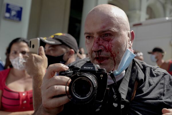 При разгоне акций протеста полицейские нанесли удары нескольким демонстрантам, а также фотографу, работающему на агентство Associated Press - Sputnik Грузия