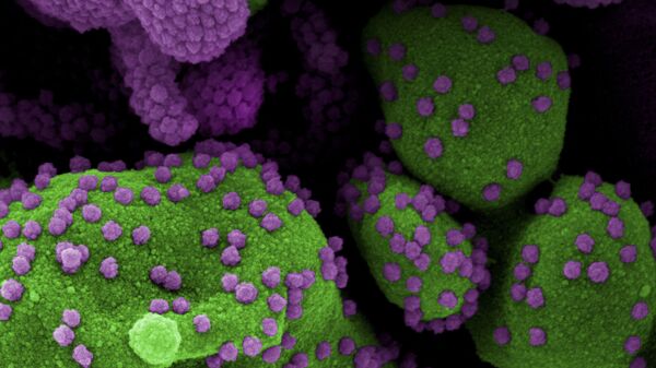Пандемия коронавируса - COVID-19 и человеческие клетки изучаются под микроскопом - Sputnik საქართველო