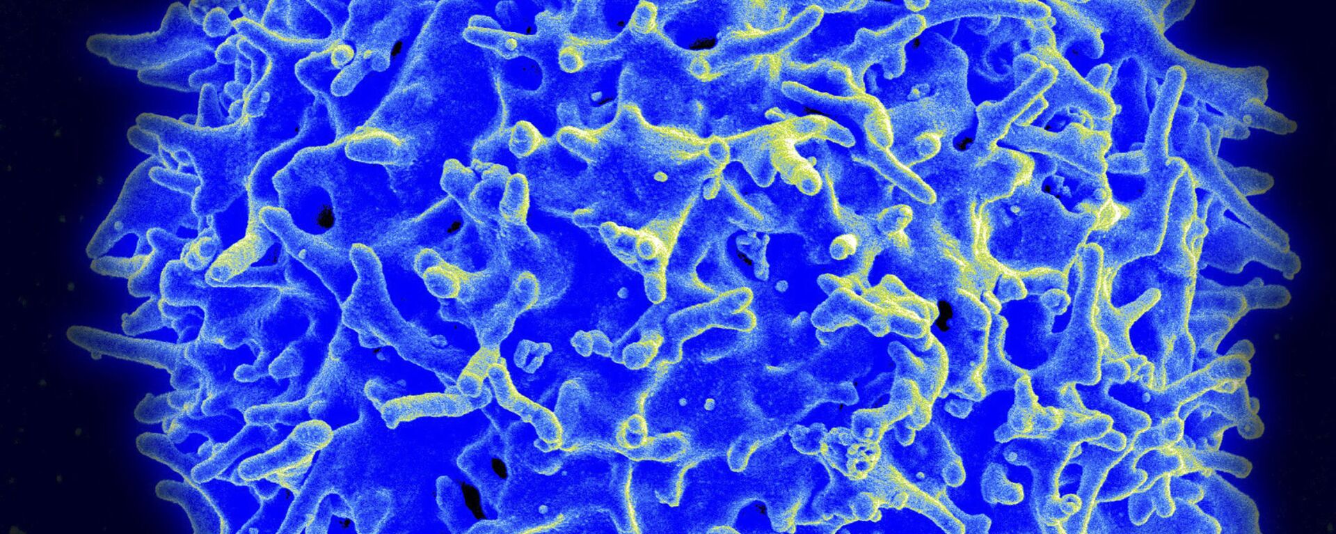Пандемия коронавируса - COVID-19 и человеческие клетки изучаются под микроскопом - Sputnik Грузия, 1920, 18.12.2021
