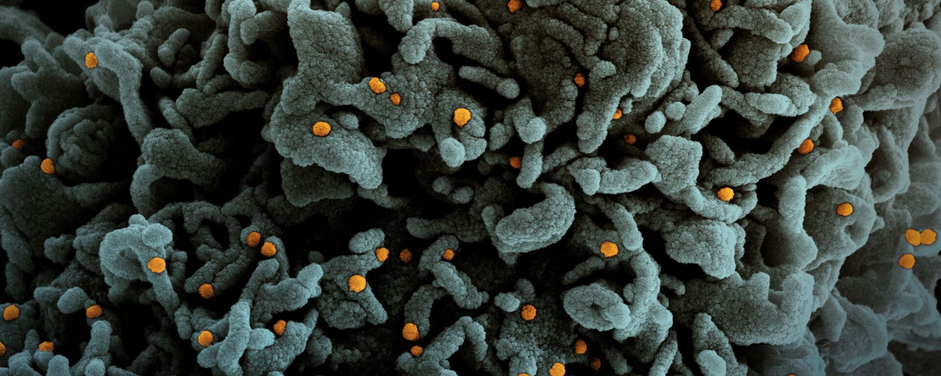 Пандемия коронавируса - COVID-19 и человеческие клетки изучаются под микроскопом - Sputnik Грузия, 1920, 13.10.2021