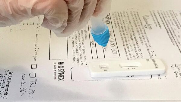PCR-ტესტი - Sputnik საქართველო