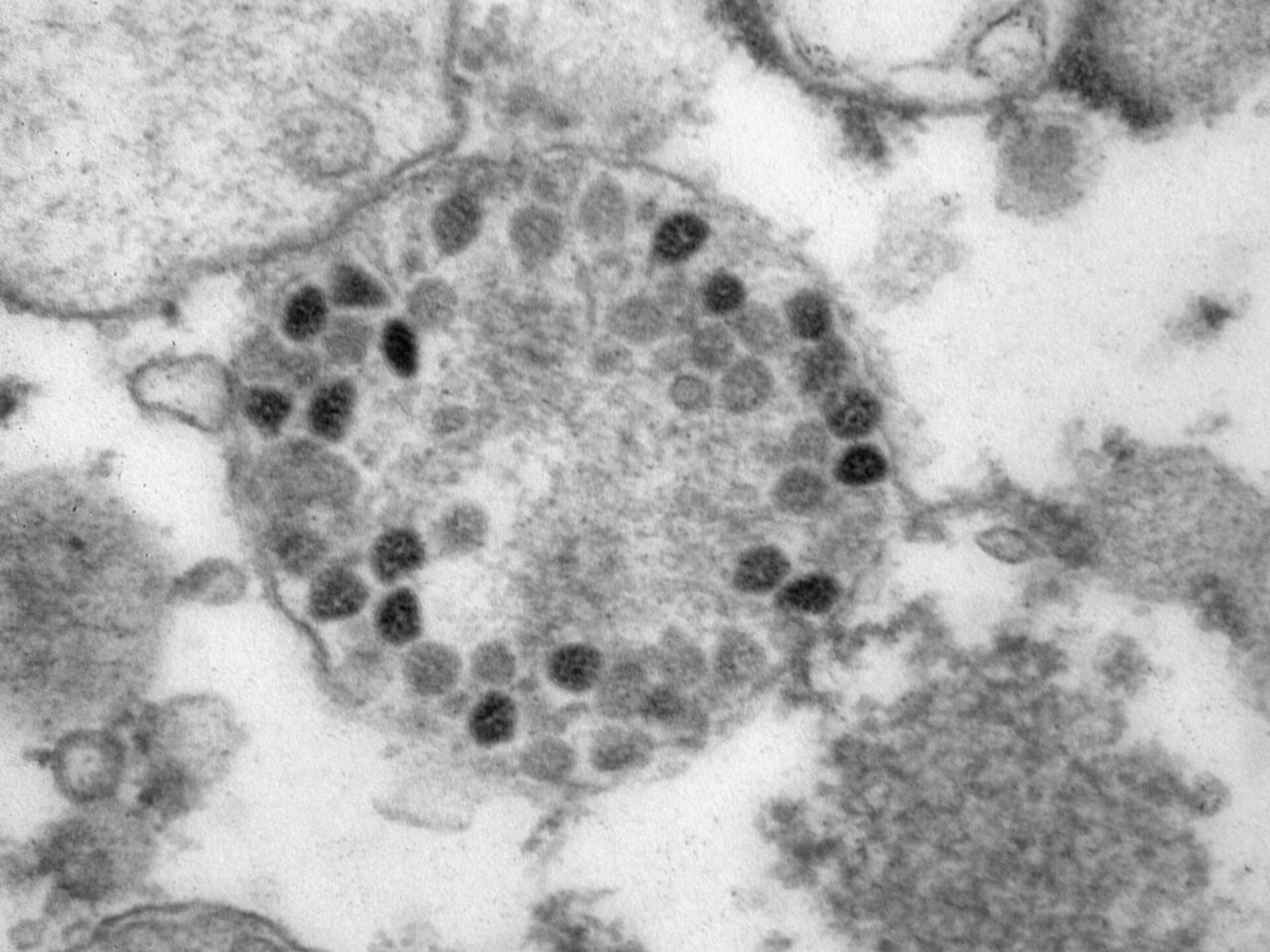 Новый штамм коронавируса 2022. Вирус Covid 19 под микроскопом. Омикрон-штамм SARS-cov-2. Коронавирус под микроскопом. Ковид Омикрон.