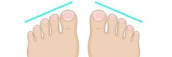 ეგვიპტური ტერფები - Sputnik საქართველო