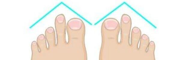 ბერძნული ტერფები - Sputnik საქართველო