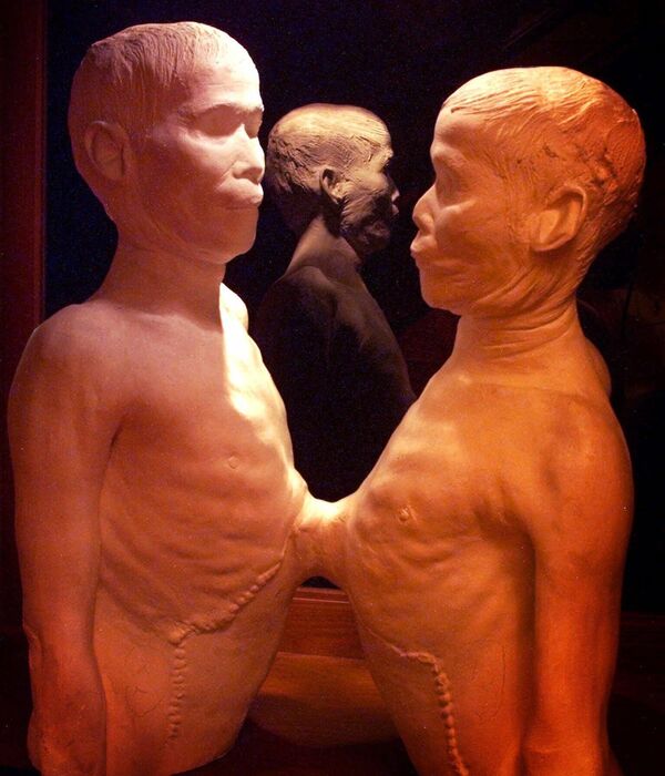 Гипсовый слепок всемирно известных &quot;сиамских близнецов&quot; Чанга и Энга выставлен в Музее Муттера в Филадельфии - Sputnik Грузия