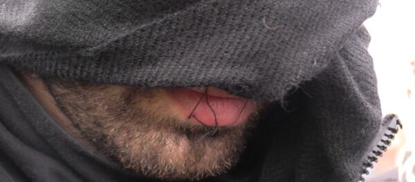 Беженцы с зашитыми ртами протестовали против сноса лагеря мигрантов в Кале - Sputnik Грузия