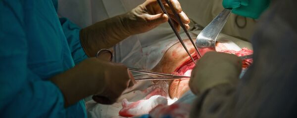 ღვიძლის გადანერგვის ოპერაცია ღვიძლის გადანერგვის ოპერაცია - Sputnik საქართველო