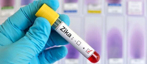 ზიკას ვირუსი ზიკას ვირუსი - Sputnik საქართველო