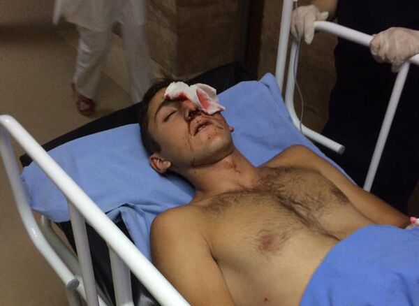 Семнадцатилетний Саят, потерявший глаз в результате разгона демонстрации в Сари тахе - Sputnik Грузия