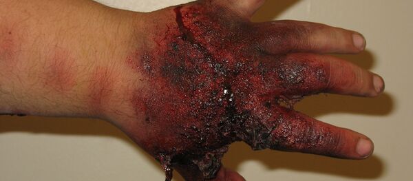 პეტარდის აფეთქების შედეგი პეტარდის აფეთქების შედეგი - Sputnik საქართველო