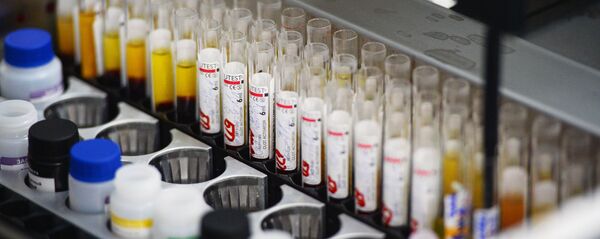 სისხლის ცენტრი - Sputnik საქართველო