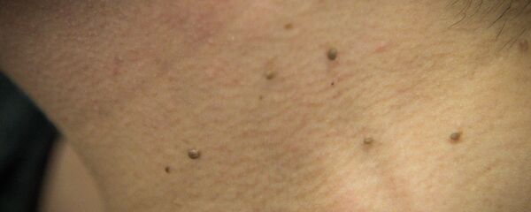 პაპილომა პაპილომა - Sputnik საქართველო