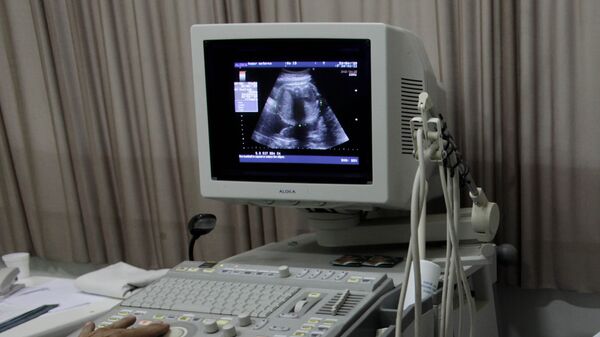 Изображение на экране монитора аппарата УЗИ во время обследования беременной женщины, фото из архива - Sputnik Грузия
