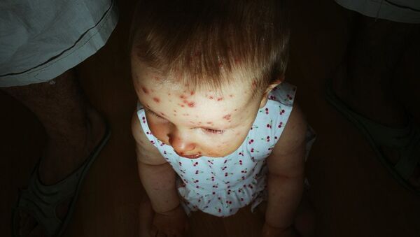 Больной ребенок, фото из архива - Sputnik Грузия