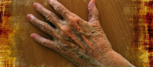 პიგმენტური ლაქები ხელზე - Sputnik საქართველო