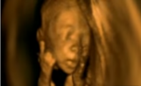 ბავშვი დედის მუცელში ბავშვი დედის მუცელში - Sputnik საქართველო