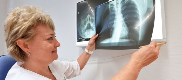 Врач рассматривает рентген  - Sputnik Грузия