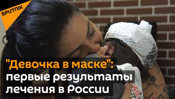 Мама девочки в маске” показала первые результаты ее лечения в России - Sputnik Грузия