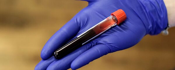 კორონავირუსი - Sputnik საქართველო