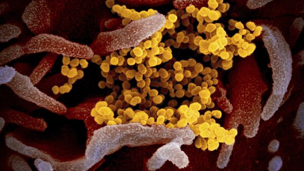 На снимке с помощью электронного микроскопа виден новый коронавирус SARS-CoV-2 желтого цвета, появляющийся на поверхности клеток. Он вызывает COVID-19 - Sputnik Грузия