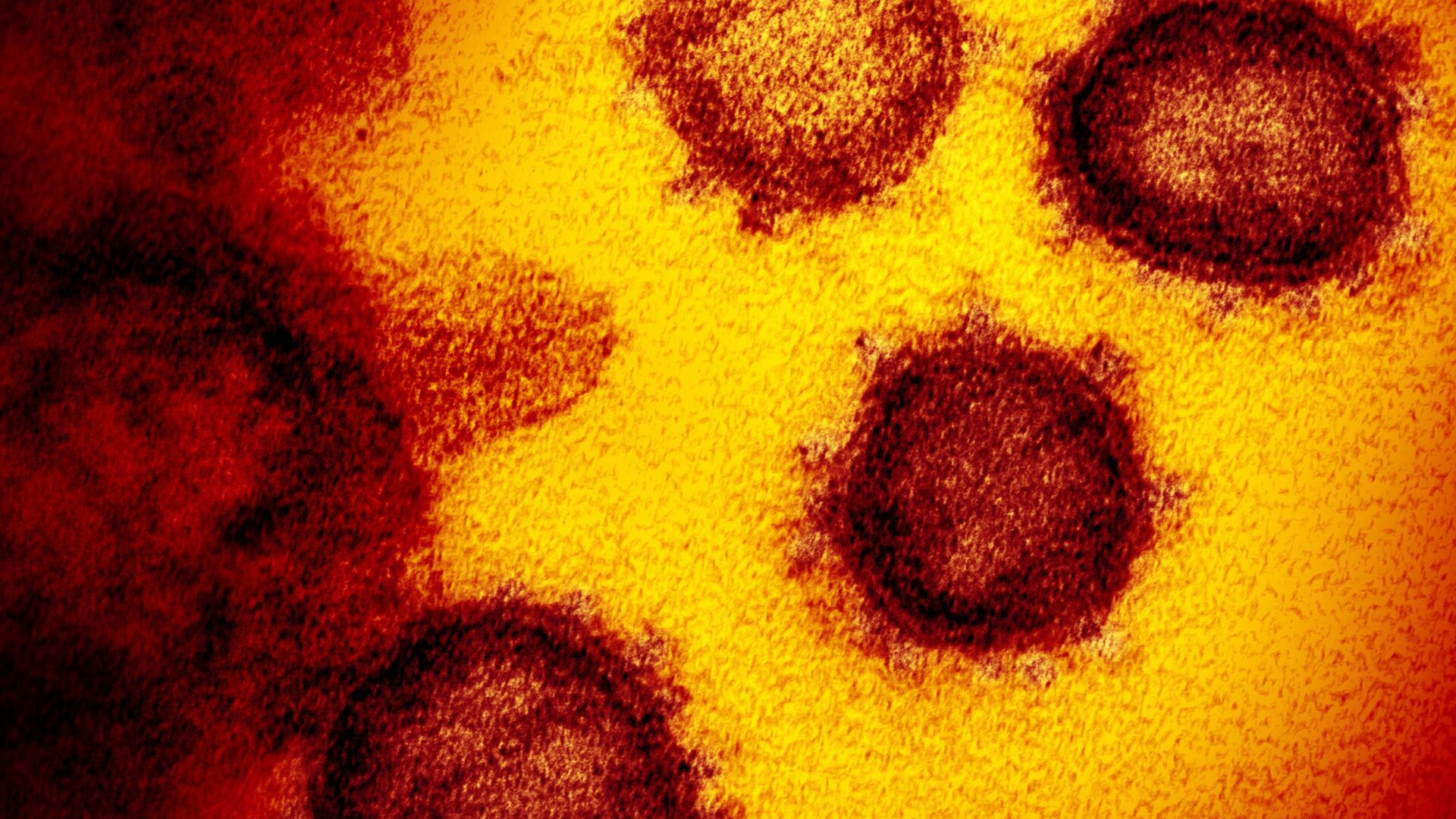 На снимке с помощью электронного микроскопа виден новый коронавирус SARS-CoV-2, появляющийся на поверхности клеток. Он вызывает COVID-19 - Sputnik Грузия, 1920, 19.01.2022