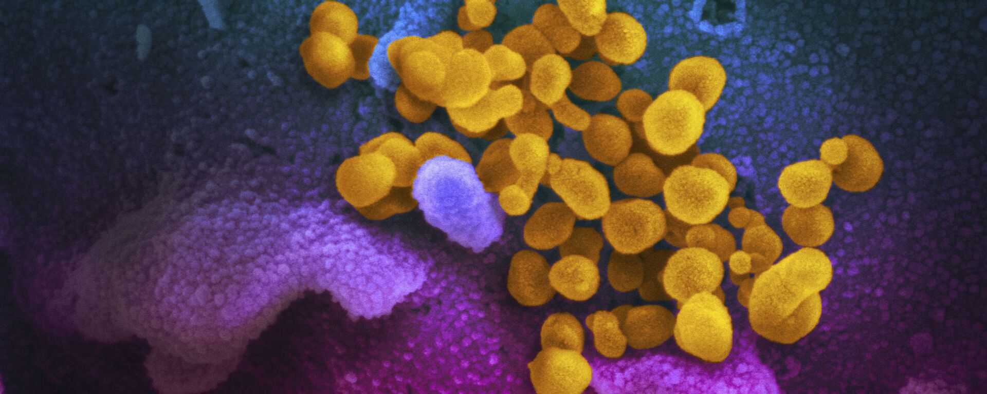На снимке с помощью электронного микроскопа виден новый коронавирус SARS-CoV-2, появляющийся на поверхности клеток. Он вызывает COVID-19 - Sputnik Грузия, 1920, 21.01.2021