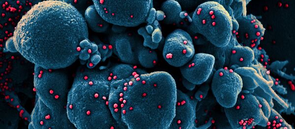 Вид на зараженную коронавирусом клетку под микроскопом - Sputnik Грузия