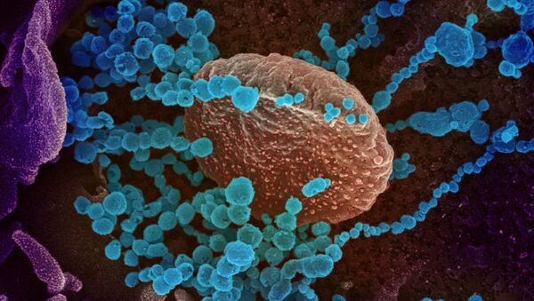 Вид на зараженную коронавирусом  клетку под микроскопом  - Sputnik Грузия