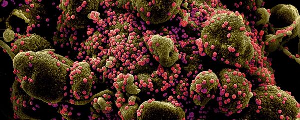 კორონავირუსით ინფიცირებული უჯრედი მიკროსკოპში კორონავირუსით ინფიცირებული უჯრედი მიკროსკოპში - Sputnik საქართველო