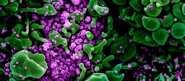 Микрофотография частиц коронавируса в клетке зараженного человека - Sputnik Грузия