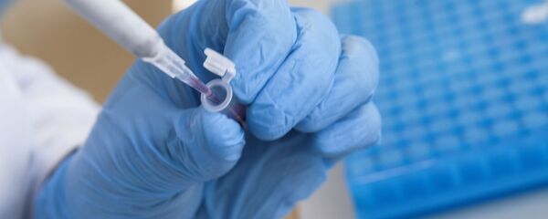 Емкость с антигеном с меткой в лаборатории Емкость с антигеном с меткой в лаборатории - Sputnik Грузия