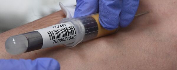 COVID-19-ის მკურნალობა - Sputnik საქართველო