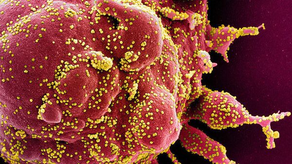 Вид на зараженную коронавирусом клетку под микроскопом - Sputnik Грузия