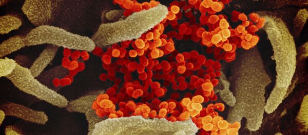 Вид на зараженную коронавирусом клетку под микроскопом Вид на зараженную коронавирусом клетку под микроскопом - Sputnik Грузия