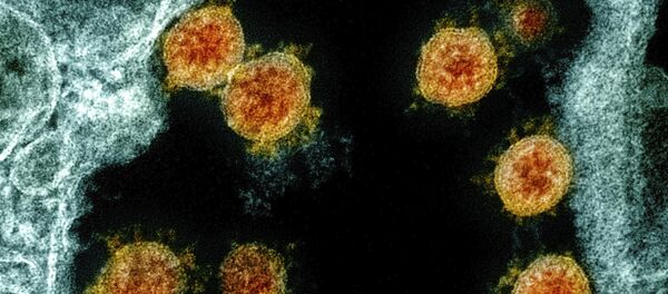 Вид на зараженную коронавирусом клетку под микроскопом  - Sputnik Грузия