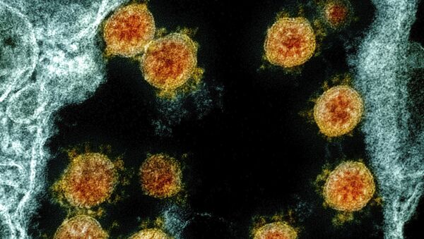 Вид на зараженную коронавирусом клетку под микроскопом  - Sputnik Грузия